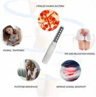 Laserbehandeling voor bekkenbodem